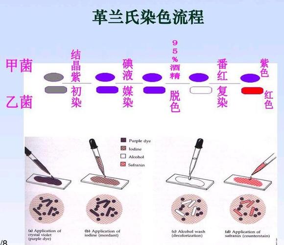 革兰染色的顺序是什么（革兰染色的原理）